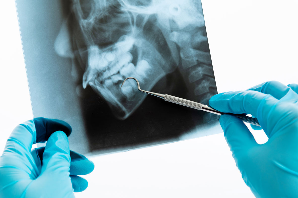 Oral and Maxillofacial Radiology